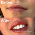 Großhandel maßgeschneiderte Private Label Peeling Repair &amp; Feuchtigkeitscreme Lippenpeeling